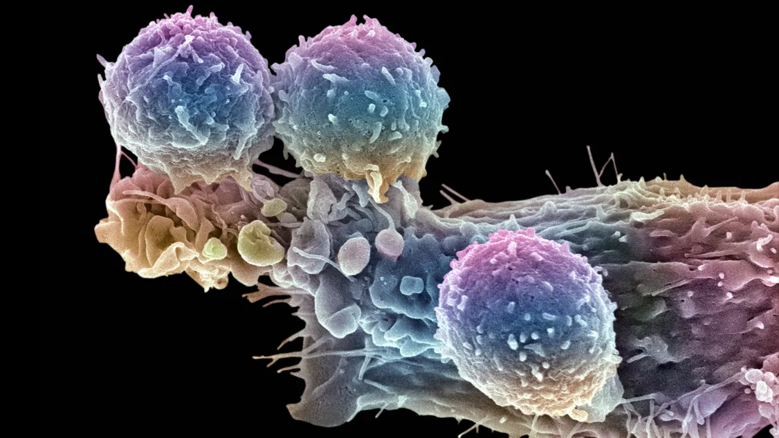 STEVE GSCHMEISSNER/SCIENCE PHOTO LIBRARY